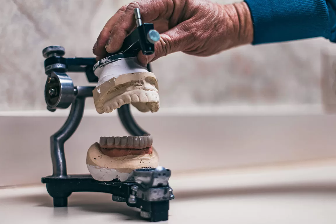 Upstate Prosthodontics Case Study 4